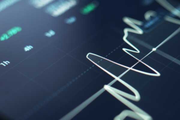 Exness百科-“周末也没歇着”！银行年末存款保卫战升级